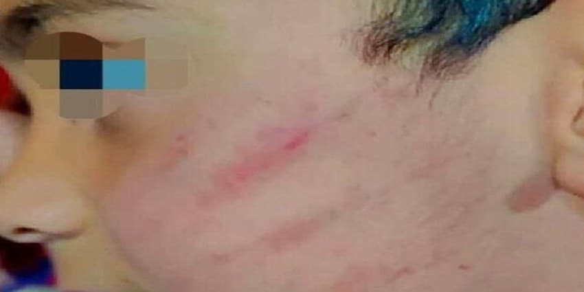 تشکیل پرونده برای معلم درپی تنبیه بدنی یک دانش‌آموز در سراوان | انرژی نویس